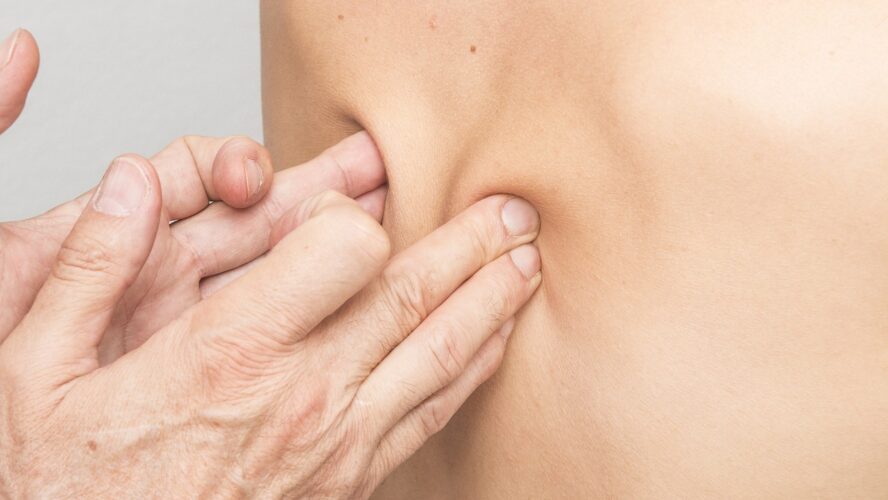 Physiotherapie